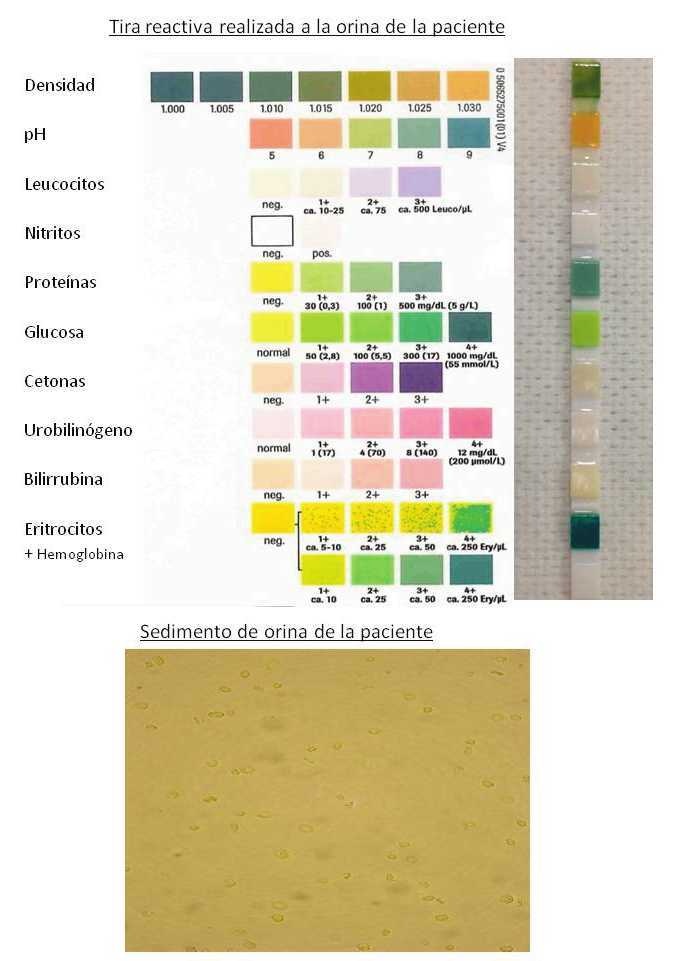 Imagen 1 de la pregunta 19 del examen MIR 2016