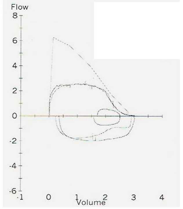 Imagen 1 de la pregunta 24 del examen MIR 2016