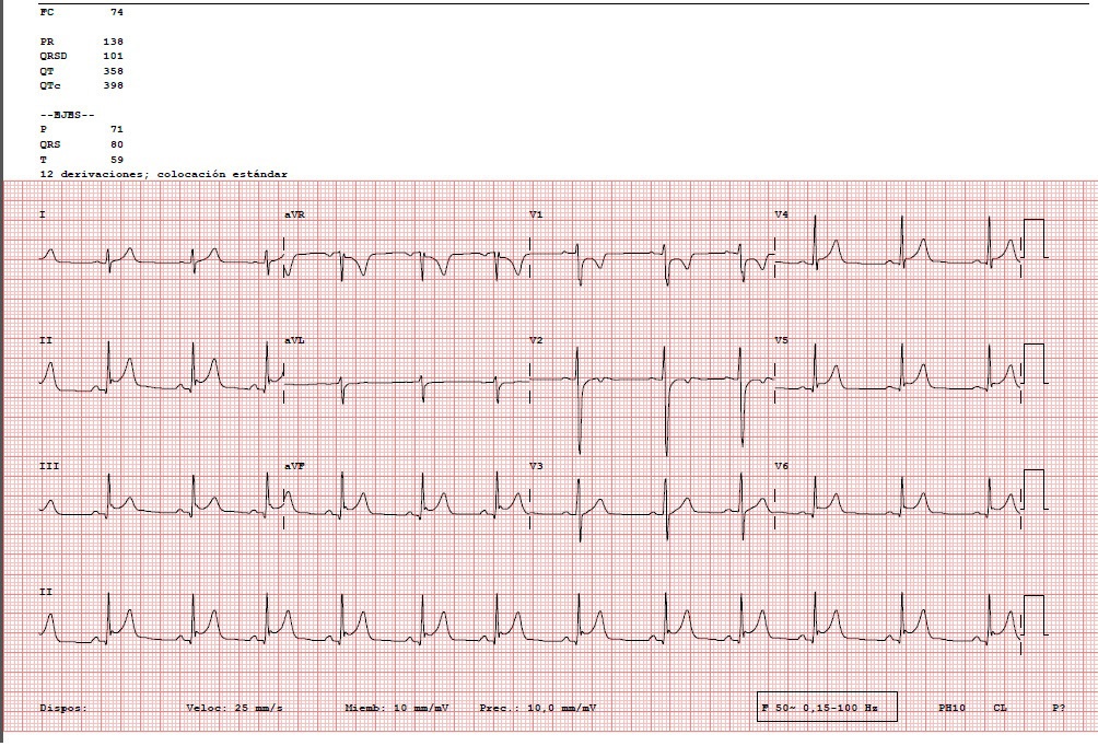 Tratamiento de la pericarditis aguda — imagen de la pregunta 23 del examen MIR 2020