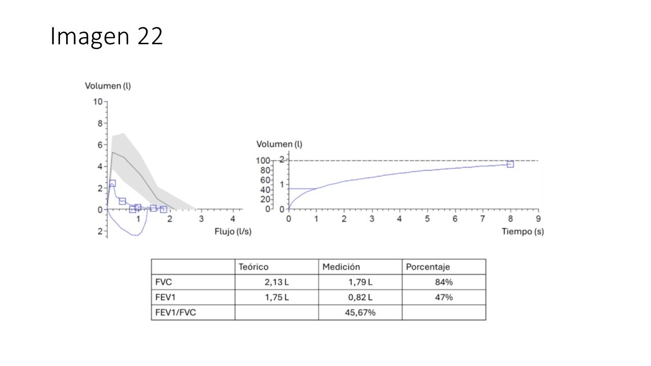 EPOC GOLD 3E eosinofílico y triple terapia — imagen de la pregunta 22 del examen MIR 2025